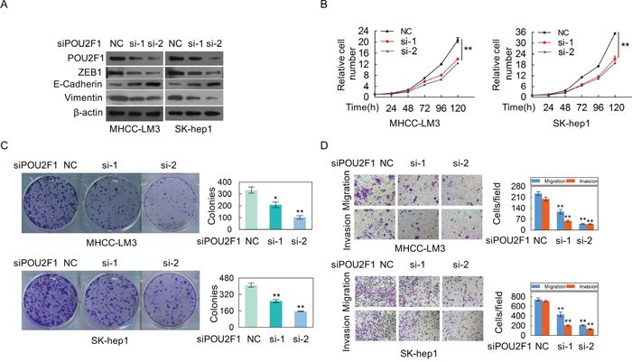 The silencing of POU2F1 inhibites the malignant phenotypes of HCC cells.
