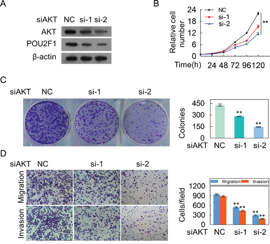 The silencing of AKT inhibites the malignant phenotypes of HCC cells.