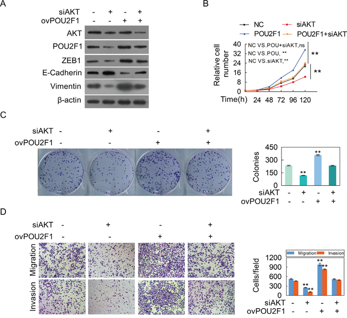 POU2F1 is a critical effector for AKT-stimulated malignant phenotypes of HCC cells.