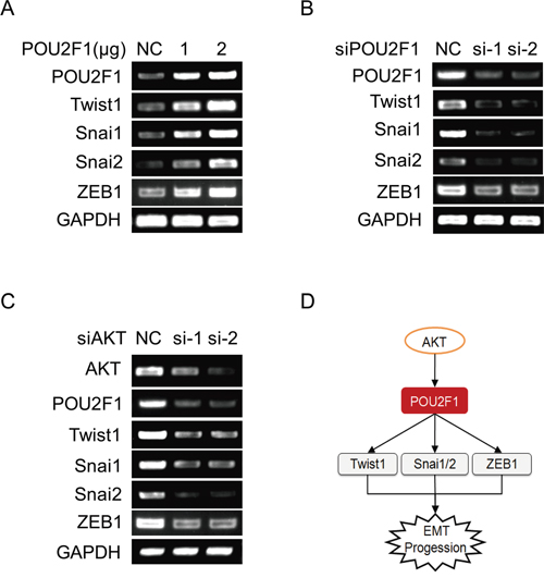 POU2F1 promotes HCC cell EMT by up-regulating the expression of EMT genes.