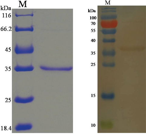 Purification of rHCcyst-2 and western blot.