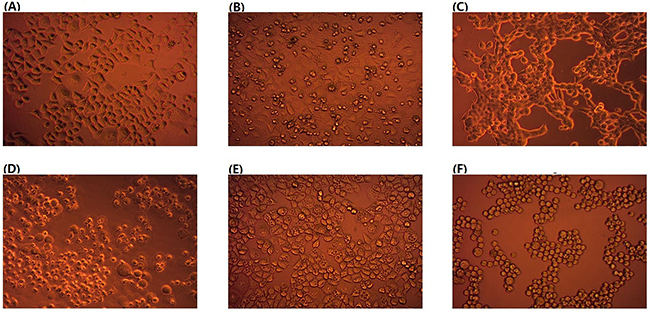 Effects of human fecal supernatant on HeLa cells.