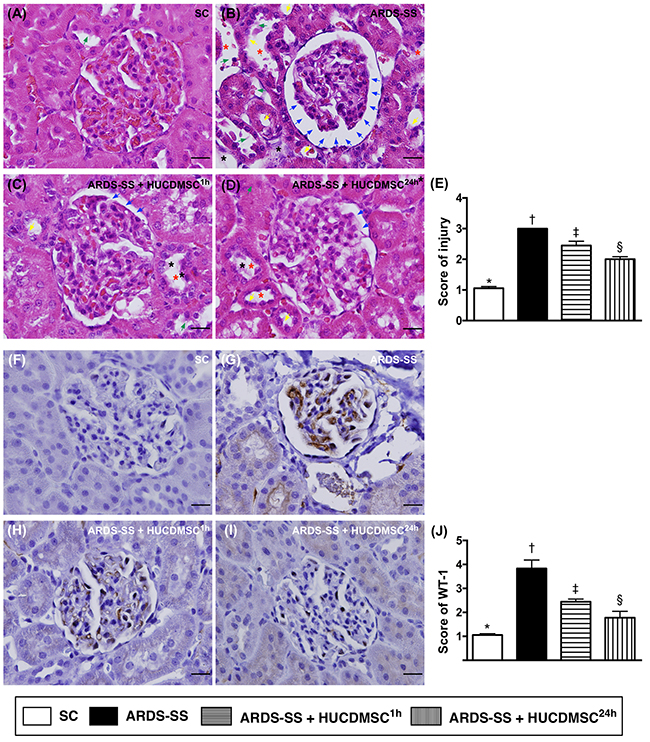 Histopathological findings of rat kidney injury and cellular expression of WT-1 by day 5 after ARDS-SS induction.