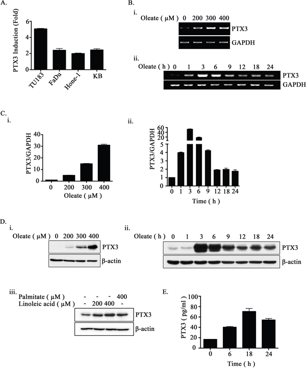 Oleate induces the expression of PTX3 in HNSCC cells.