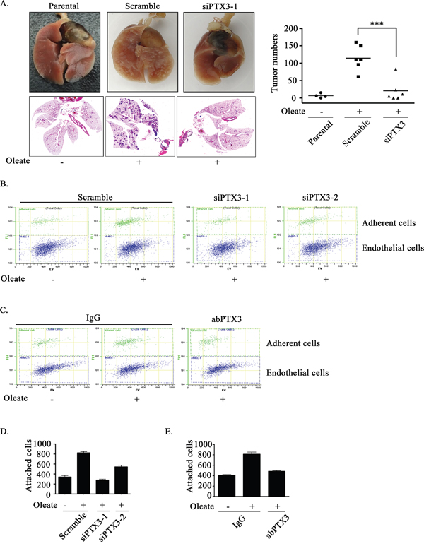 Oleate-induced autocrine production of PTX3 enhances tumor metastasis.