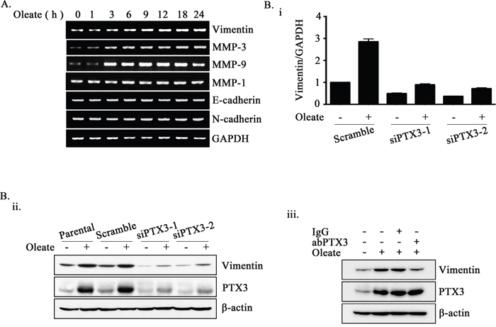 Oleate-induced PTX3 regulates the expression of vimentin.