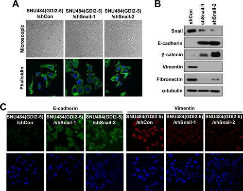 Snail is critical for RhoGDI2-induced EMT in gastric cancer cells.