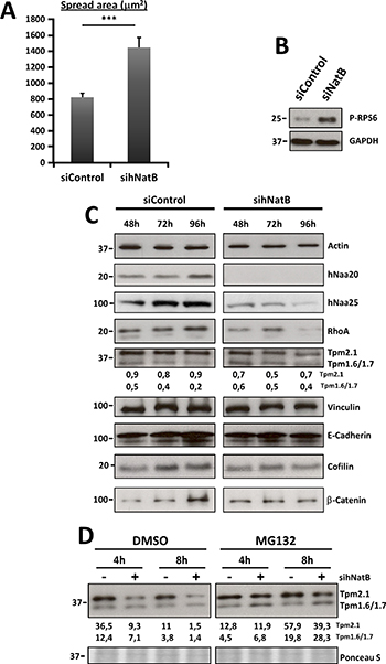 Effects of hNatB downregulation on cell size and actin cytoskeleton protein expression on PLC/PRF/5 cells.