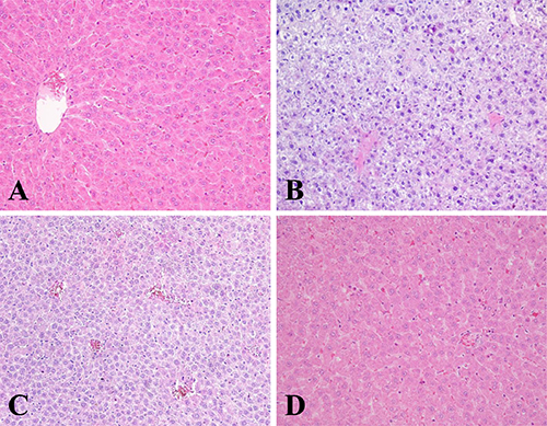 The histological of livers changed after different treatments.