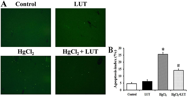 Apoptosis index was determined using TUNEL assays.