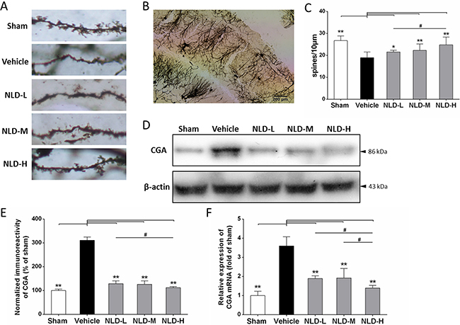 Effects of NLD on dendritic spines of neuron and release of Chromogranin A (CGA) in A&#x03B2;1-42-infused rat model.