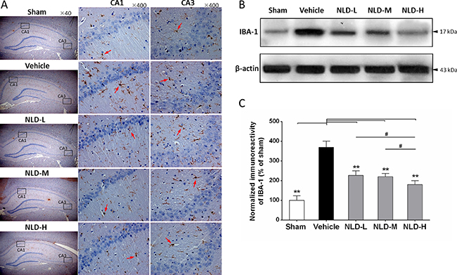 NLD inhibits microglial activation in hippocampus after intracerebroventricular injection of A&#x03B2;1-42.