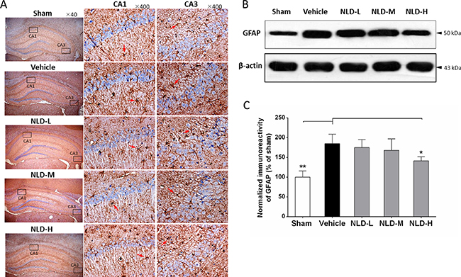 NLD inhibits astrocyte activation in hippocampus after intracerebroventricular injection of A&#x03B2;1-42.