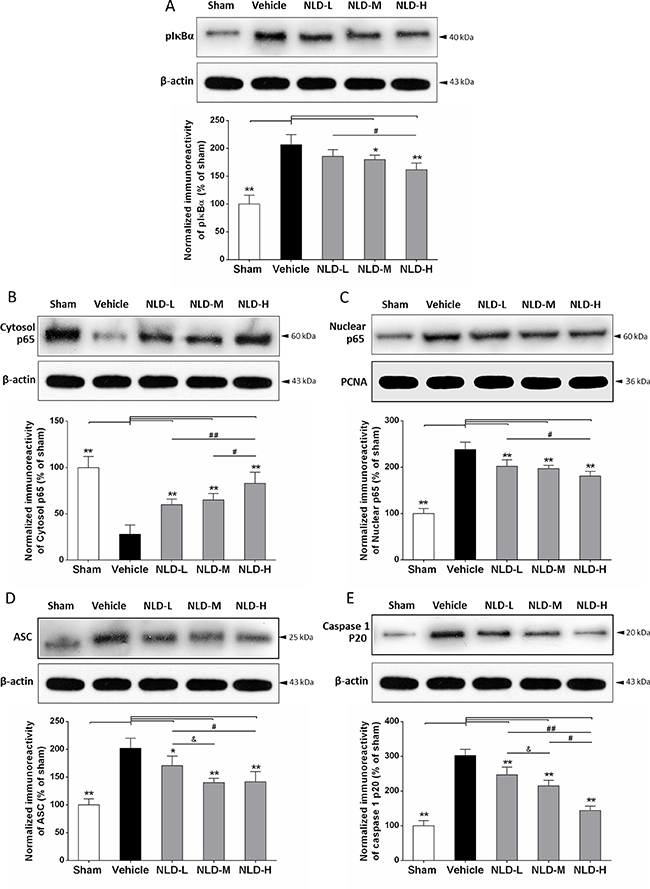 NLD inhibits the NF-&#x03BA;B signaling pathway and ASC-depending inflammasome in the hippocampus after intracerebroventricular injection of A&#x03B2;1-42.