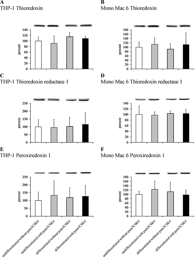 Thioredoxin antioxidant system protein content in monocyte/macrophage cell lines.