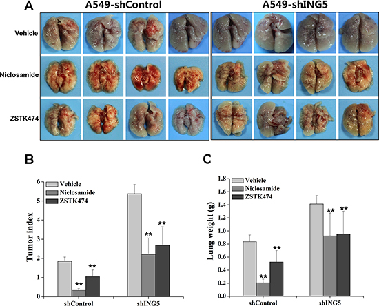 Inhibition of STAT3 or PI3K/Akt pathway impairs ING5 knockdown-promoted cancer cell metastasis in vivo.
