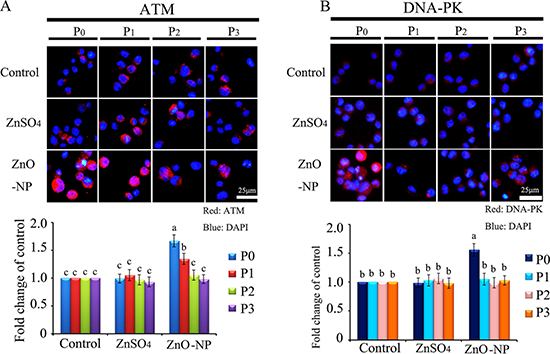 IHF images for ATM and DNA-PK in ZnO NPs treated CHO-K1 cells.