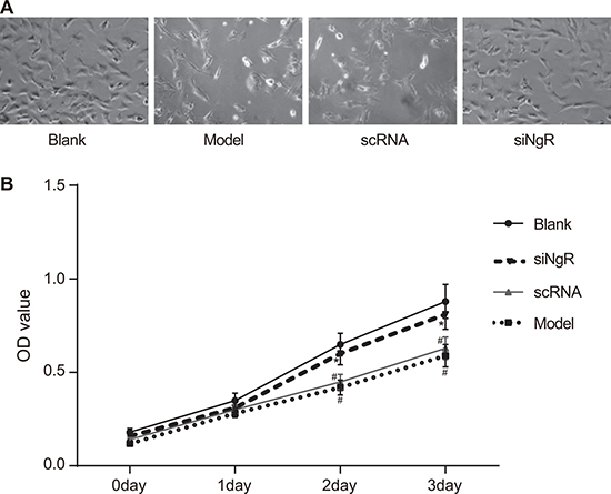 NgR gene silencing promotes proliferation of NMDA-treated mRGCs.