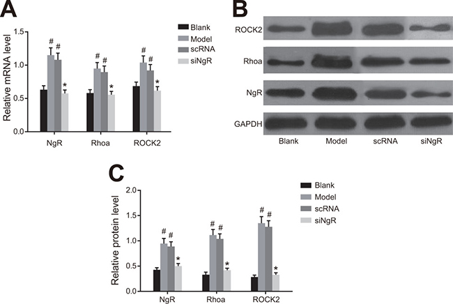 The effect of NgR silencing on RhoA signaling pathway in NMDA-treated mRGCs.