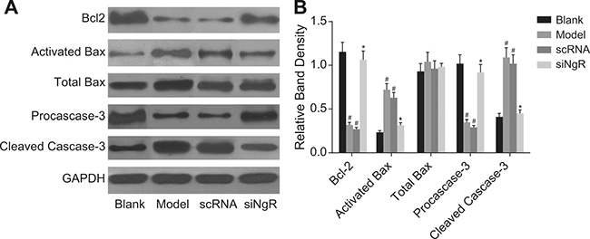 The effect of NgR silencing on expression of apoptosis-related proteins in NMDA-treated mRGCs.