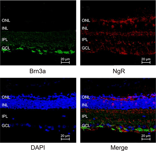 Immunofluorescence analysis of Brn3a and NgR expression in mRGCs from murine retinal tissues.