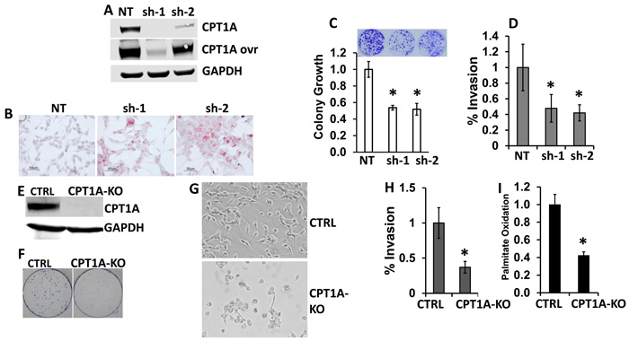 CPT1A is needed to maintain viability and invasion of prostate cancer cell lines.