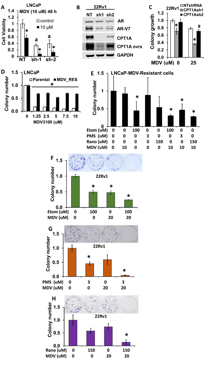 Combinatorial effects of CPT1A inhibition and anti-androgen therapy in human PCa cells.