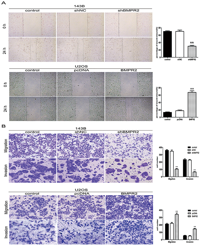 BMPR2 silencing decreases osteosarcoma cell migration and invasion.