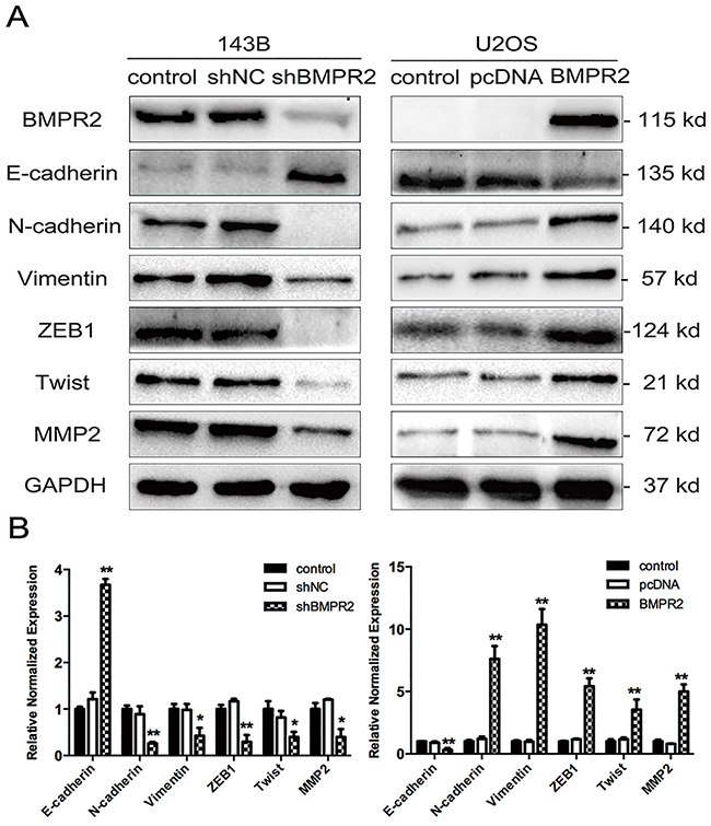 Effect of BMPR2 expression on MET progression.