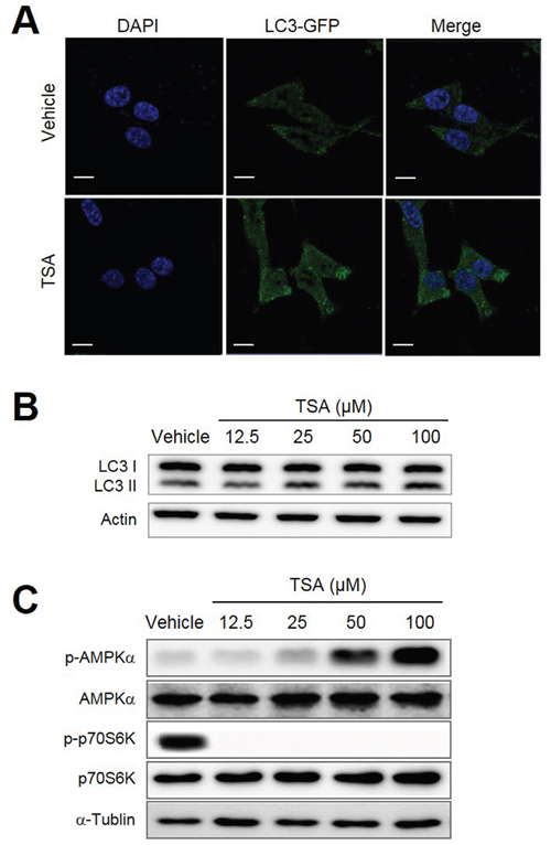 TSA induced autophagy within tumor cells.