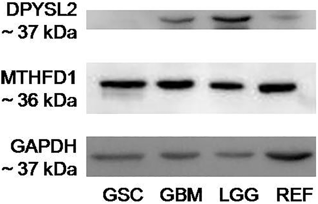 Western blotting for specific binding of Nb314 and its antigen, DPYSL2.