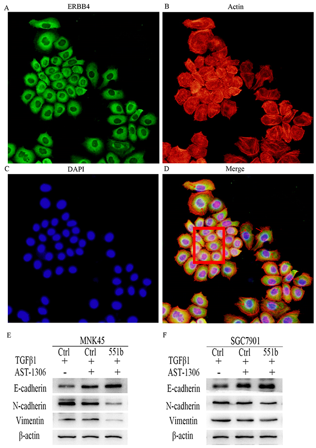 ERBB4 expression regulates EMT in MNK45 cells induced by TGF-&#x03B2;1.