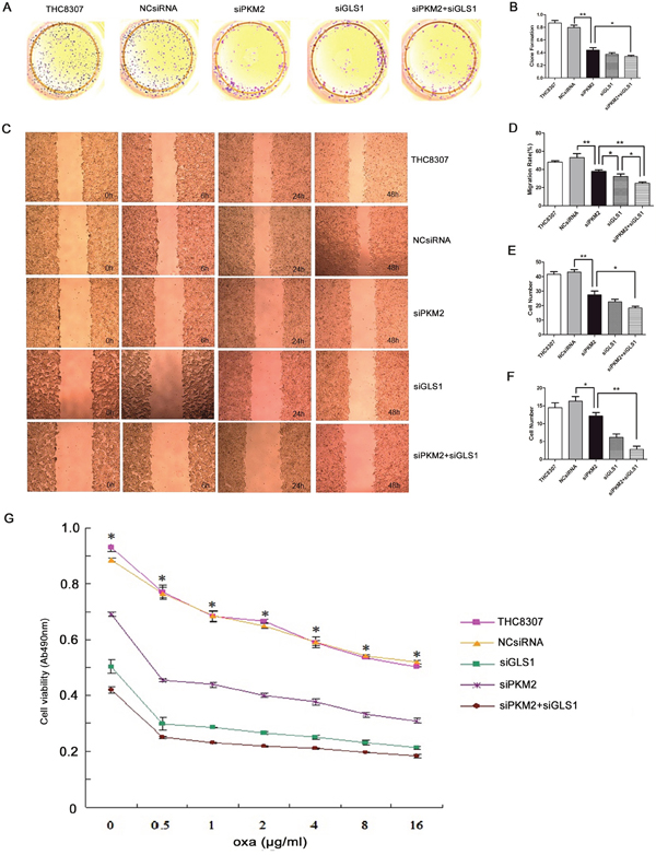 Evaluation of malignant behaviors after knocking-down PKM2/GLS1 expression in the THC8307 cell line.