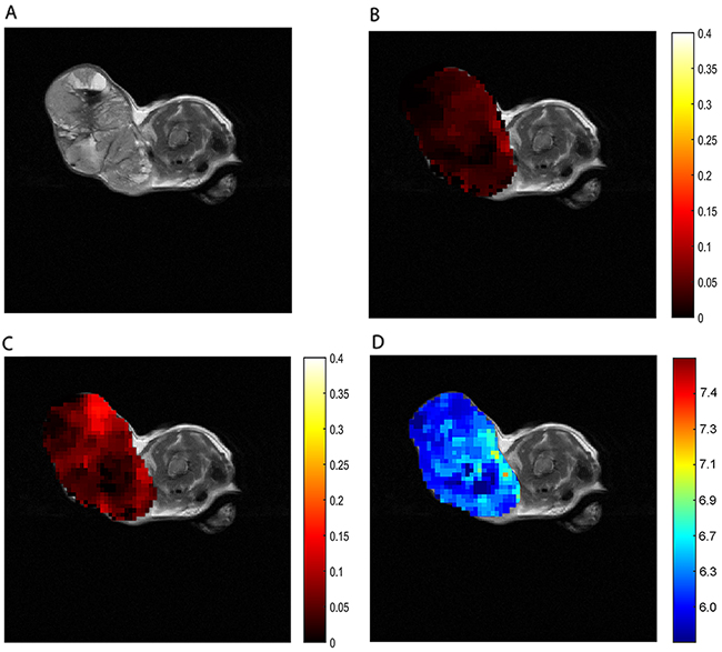 In vivo CEST imaging of breast cancer.