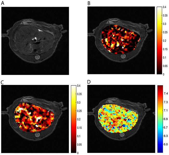 CEST imaging of normal liver tissue.