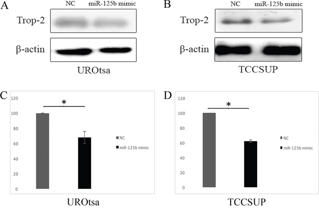 Effects of miR-125b on Trop-2 expression in transfected UROtsa and TCCSUP cells and negative control (NC).