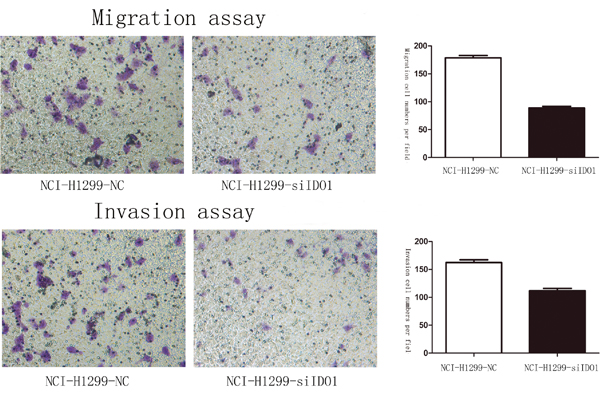 Downregulation of IDO1 significantly suppressed cell migration and invasion in NCI-H1299 Lung cancer cell.