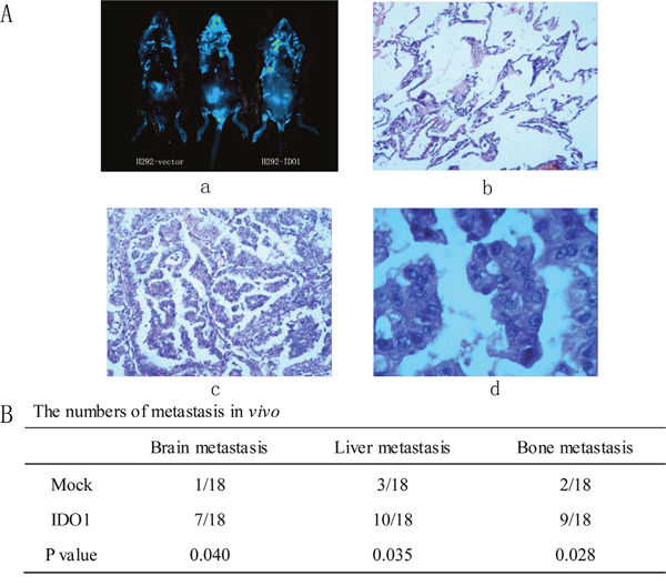 Representative H&#x0026;E-stained sections of the lung tissues isolated from mice that seeded into lungs with NCI-H292-IDO1 or NCI-H292-Vector cells directly.
