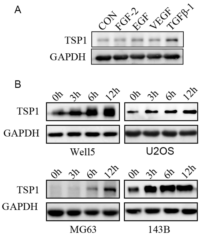 Regulation of TSP1 expression in osteosarcoma cells by TGF-&#x03B2; pathways.