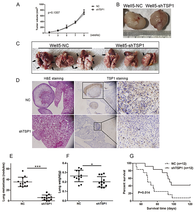 Sliencing of TSP1 inhibits lung metastasis of osteosarcoma cells.