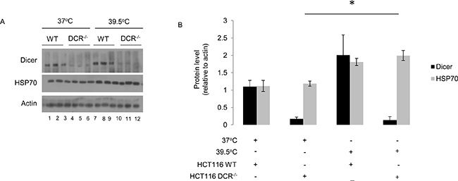 Elevated dicer protein levels observed during mild (39.5&#x00B0;C) hyperthermia-induced thermotolerance are not linked to HSP70 protein levels.
