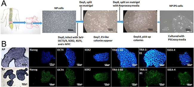 Overview of the NP-iPSC generation protocol and immunostaining of specific markers.
