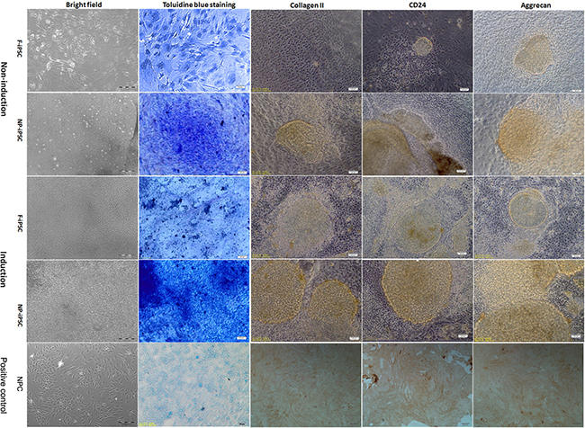 Differentiation analysis of iPSCs.