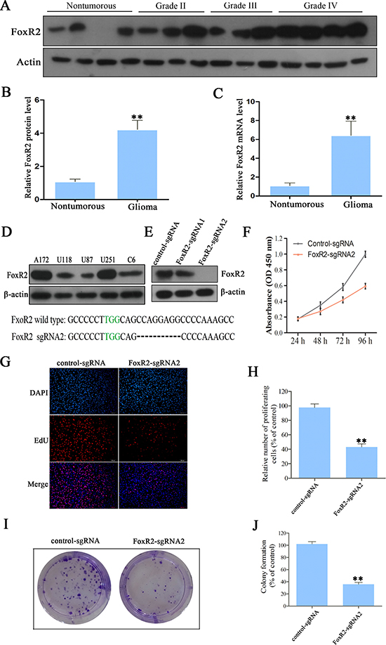 The effects of FoxR2 knockout on cell proliferation of glioma.