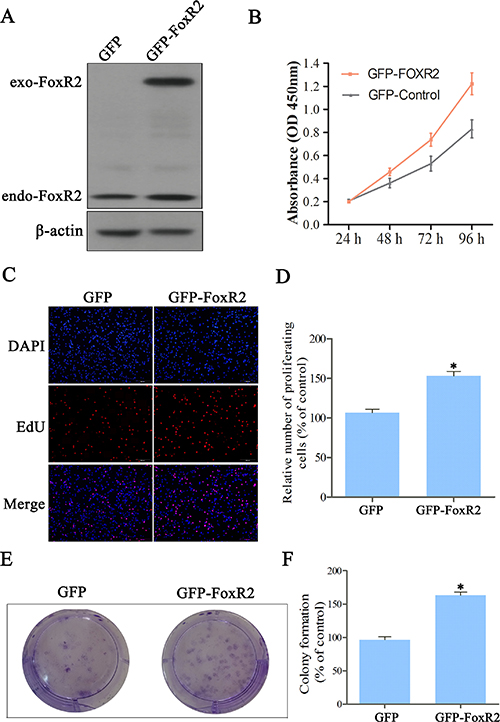 Overexpression of FoxR2 promotes proliferation of glioma cells.