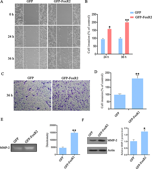 Overexpression of FoxR2 promotes the migration and invasion of glioma cells.
