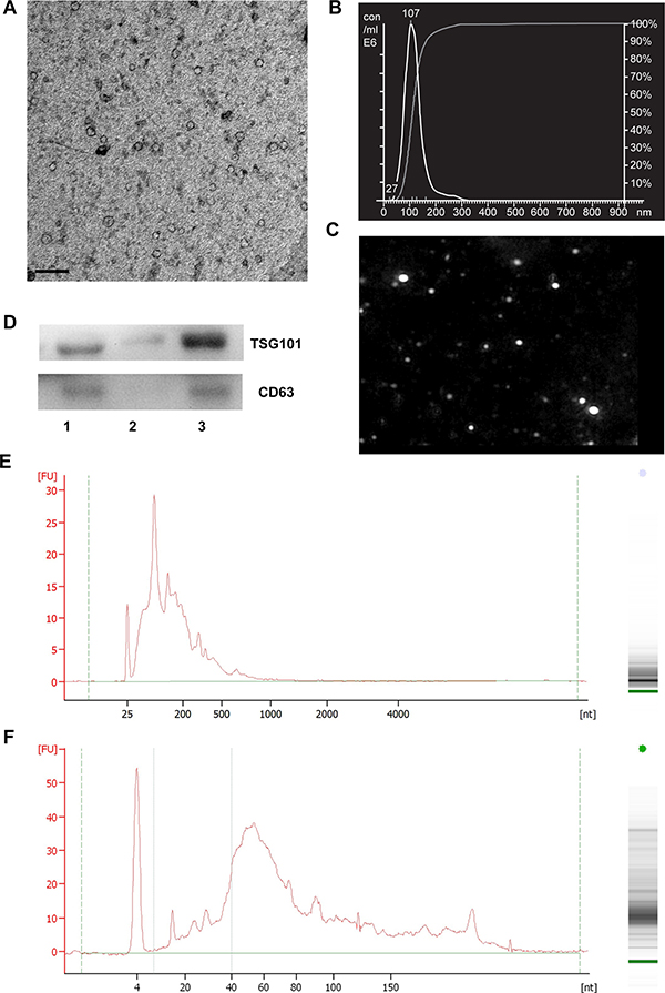 Characterization of exosomes isolated from mouse serum by Exoquick precipitation.