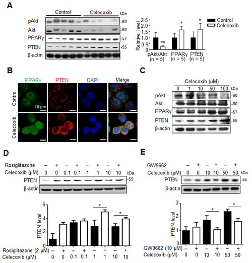 Fig 5: PPAR&#x3b3;/PTEN signaling contributes to celecoxib-induced Akt inhibition.