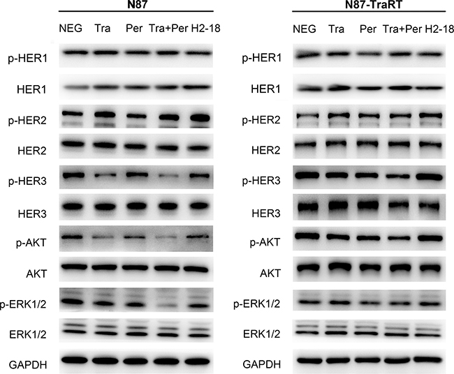 H2-18 inhibits the downstream signaling pathways of ErbB2 in NCI-N87 cells but not in NCI-N87-TraRT cells.
