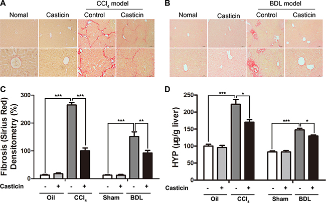 Effect of casticin on alleviation of CCl4-and BDL-induced hepatic fibrosis.